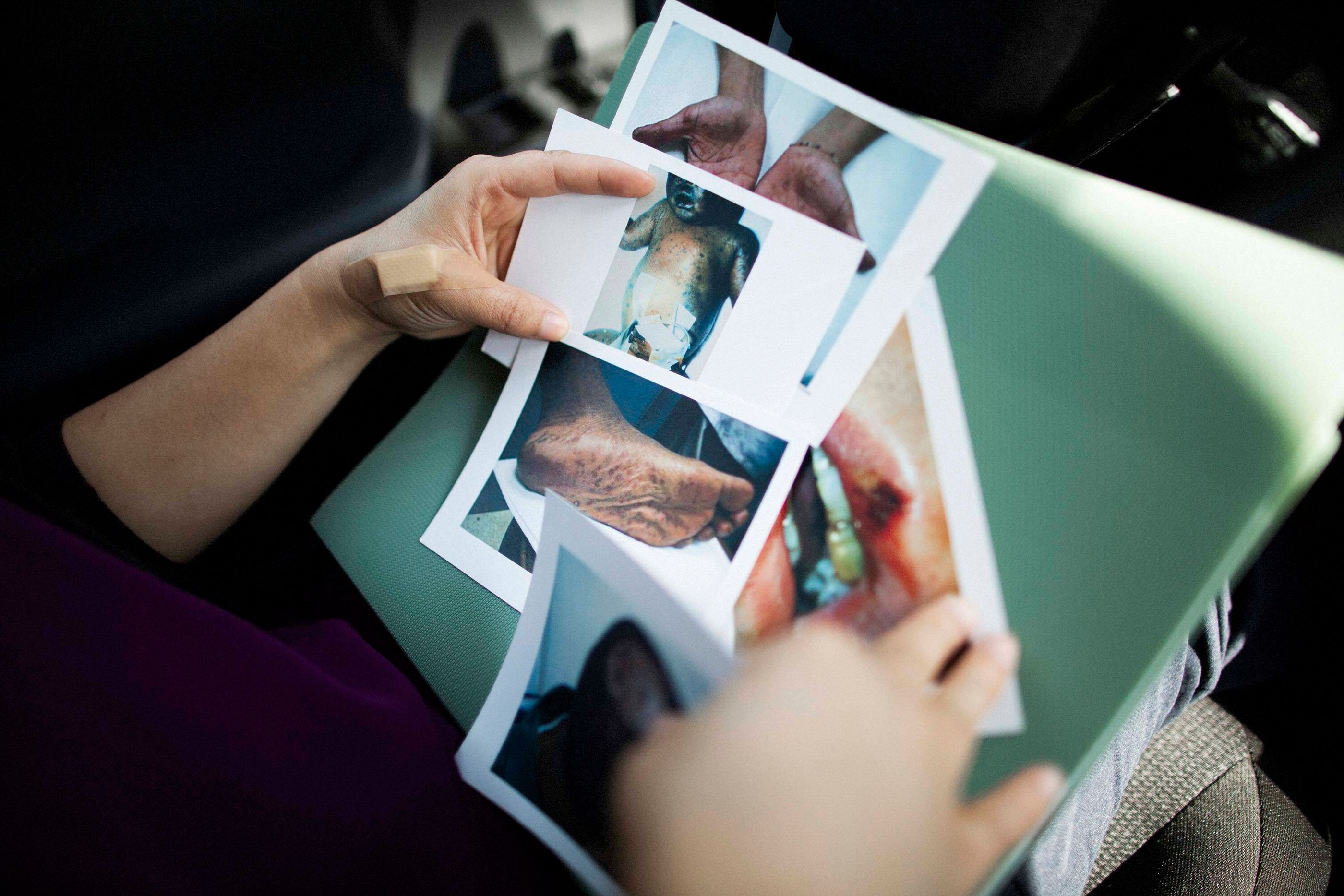 20211029 syphilis contact tracing talia herman 01